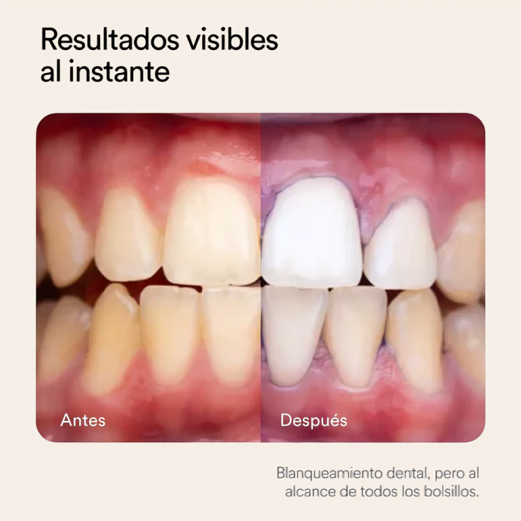 LUMEA V34 - Blanqueador Dental