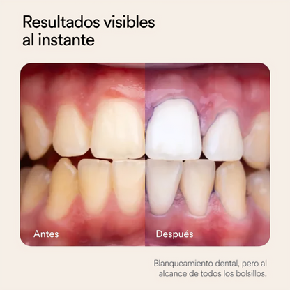LUMEA V34 - Blanqueador Dental